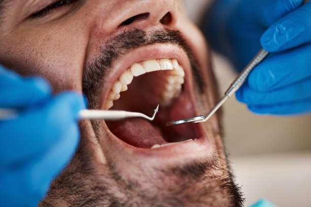 Best Emergency Treatment for Toothache in Navy, VA