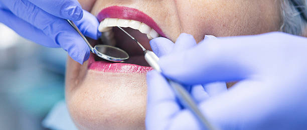 Best Emergency Tooth Extraction in Navy, VA